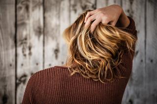 Why am I losing so much hair? Here are common causes and conditions