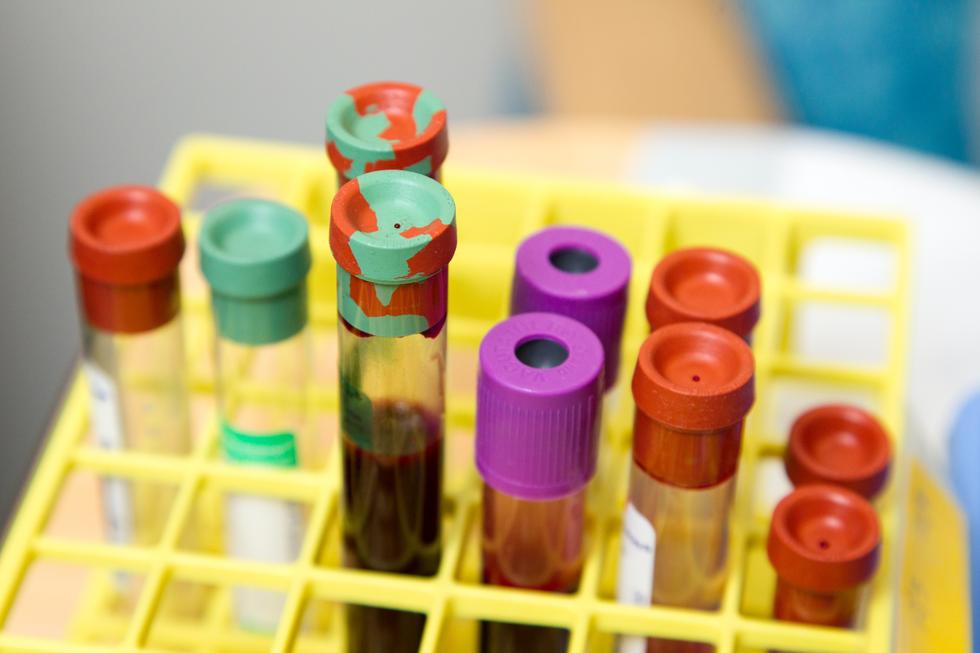 Why you should do a blood test - Five reasons