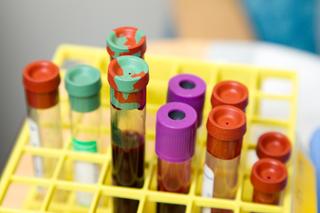 Why you should do a blood test - Five reasons