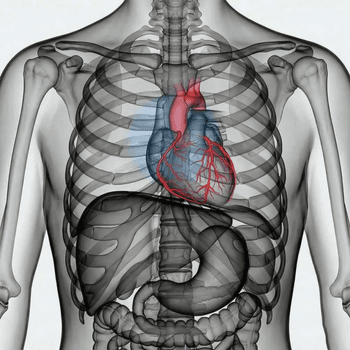 CT hjärta – Angio