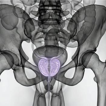 MRI Prostate