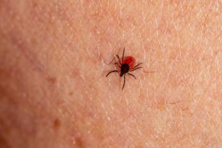 “Is it dangerous if the tick's head is still attached?” And 9 other frequently asked questions and answers about ticks