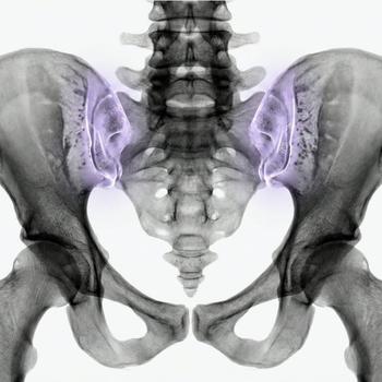 MRI Hip joint and pelvis