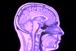 Vad visar en MR-undersökning av hjärnan?