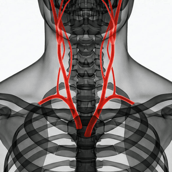 CT halskärl - 3D Angio