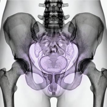 MR Lilla bäckenet (gyn)