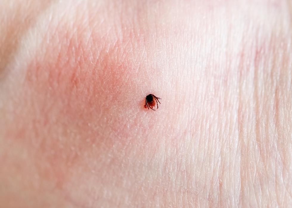 How can you tell if you have contracted Lyme disease?