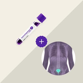 Prostate Check – MRI & Stockholm3