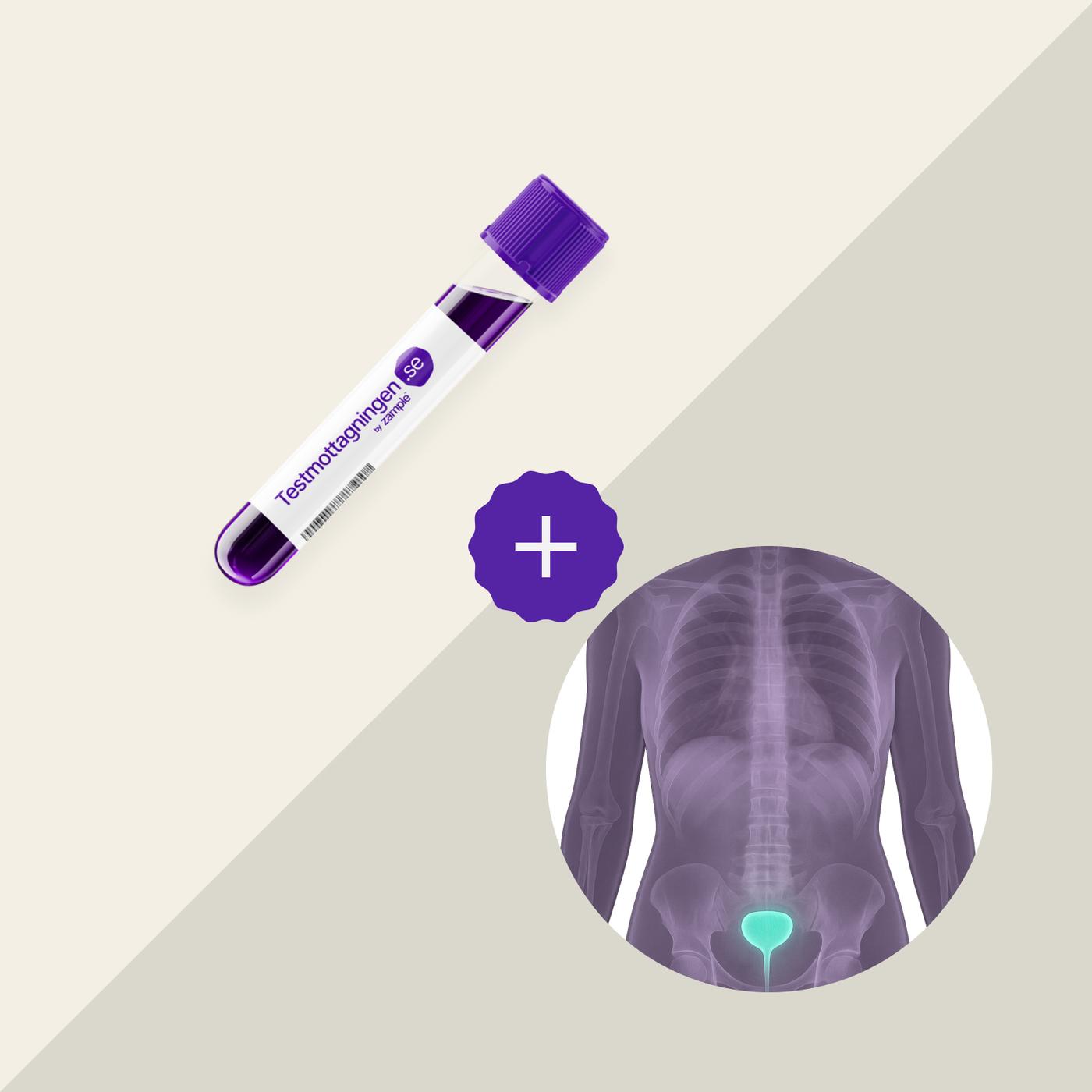 Prostatascreening plus